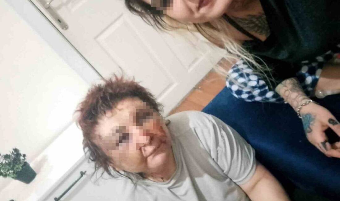 Ankara’da bir kadını zorla alıkoyarak darp eden 2 kişi, polis