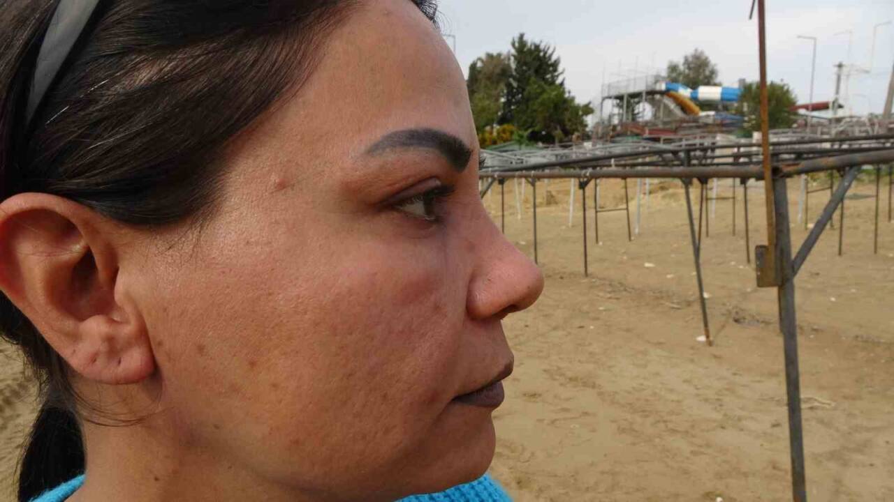 Antalya’da 40 yaşındaki Ada Mert, estetik işlemler sonrası yaşadığı sorunlar