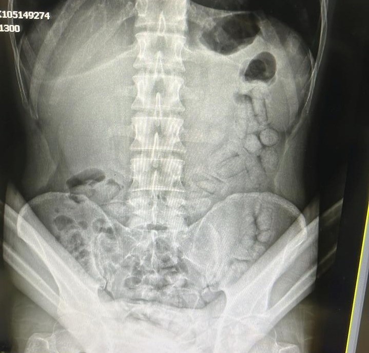 GÜMÜŞHANE (İHA) – Gümüşhane’de polis ekiplerinin kontrol noktasında durdurduğu araç