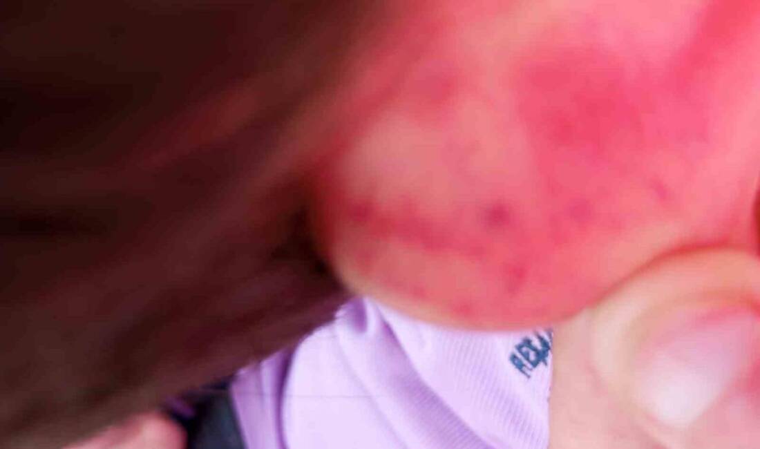 Muğla’nın Datça ilçesinde 10 yaşındaki otizmli çocuğu darbeden şahıs, açılan