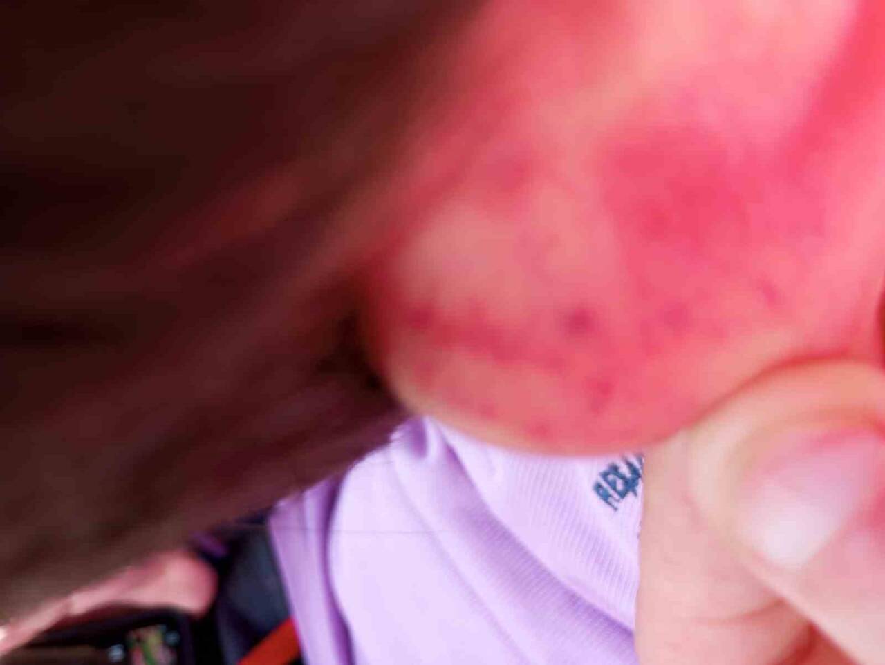 Muğla’nın Datça ilçesinde 10 yaşındaki otizmli çocuğu darbeden şahıs, açılan