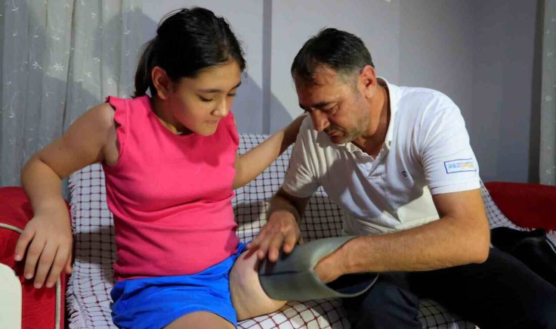 Muratpaşa'da yaşayan 12 yaşındaki Özge Yıldırım, dar gelen protezi için
