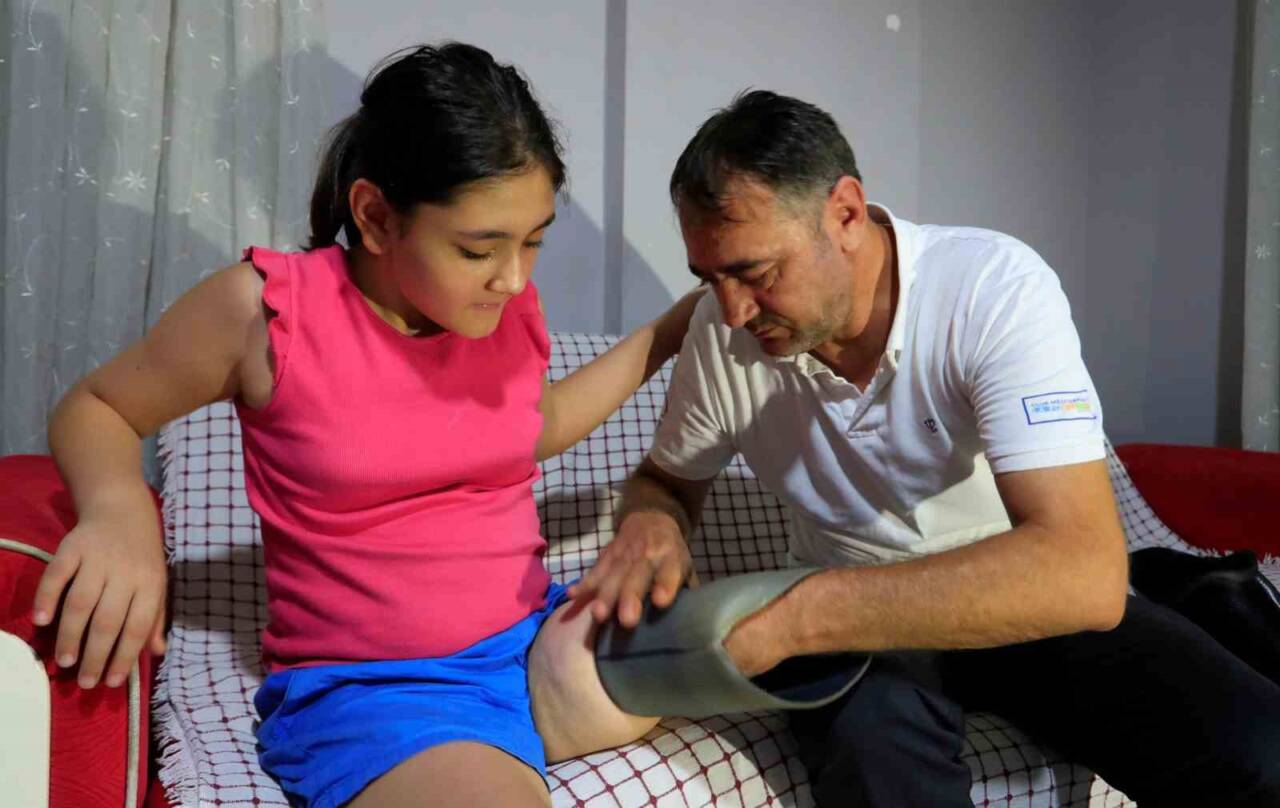 Muratpaşa'da yaşayan 12 yaşındaki Özge Yıldırım, dar gelen protezi için